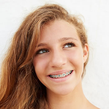 orthodontic faqs